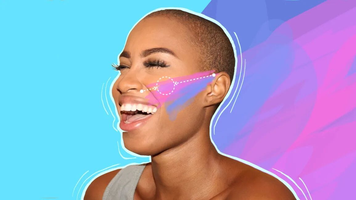 Defining Your Features: Achieving High Cheekbones with Dermal Fillers