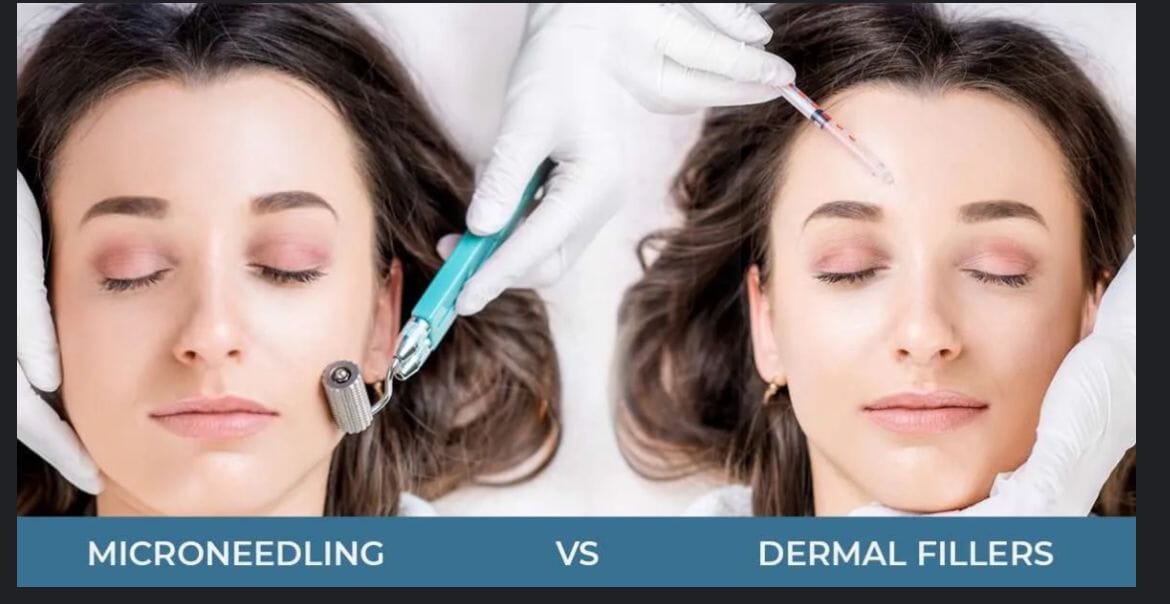 Dermal Fillers vs. Anti-Aging Treatments