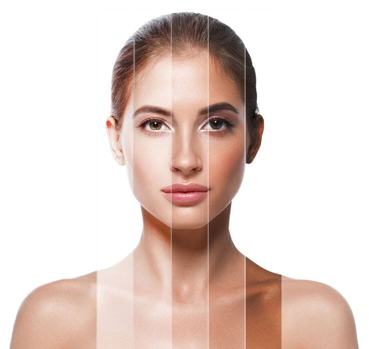Maximizing the Benefits of Dermal Fillers