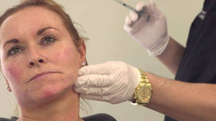 Understanding Allergic Reactions: Are Dermal Fillers Safe?