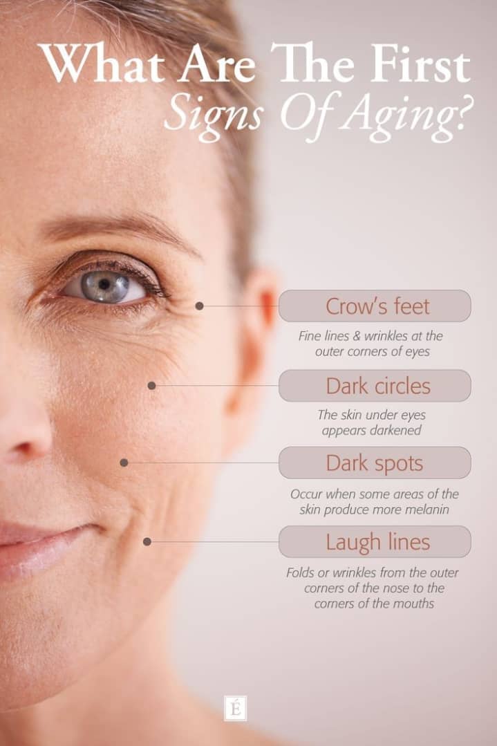 What Are the First Signs of Aging?