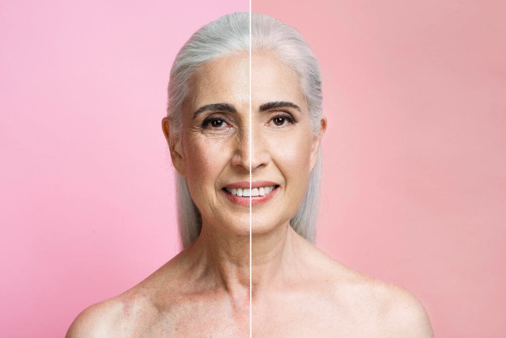 Why Getting Botox Is A Good Idea.