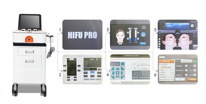High-intensity focused ultrasound (HIFU) Laser brunodermalfiller.com 