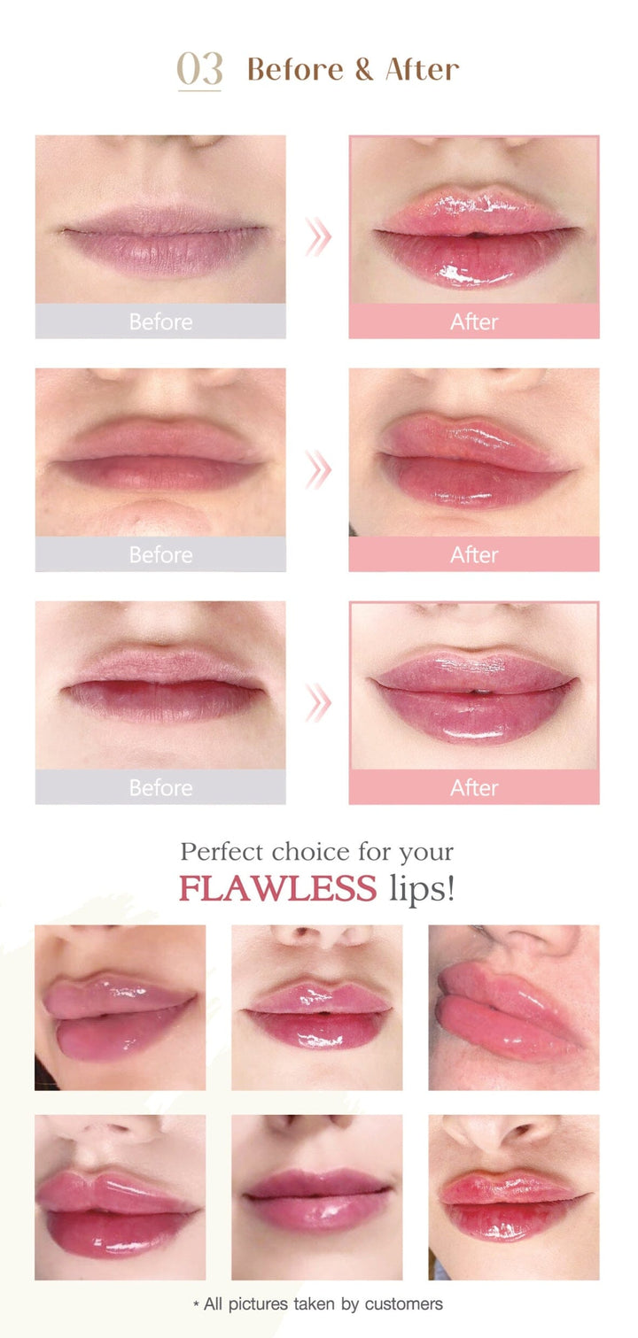FLAWLESS SUB-Q brunodermalfiller.com 